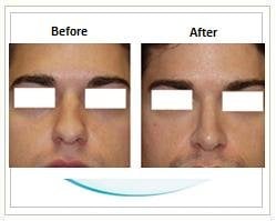 Slider image (2) Aesthetic Cosmetic Plastic Surgery Center Bolivia - SensualBodyDream